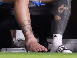 Foto: Penampakan Kaki Bengkak Lionel Messi di Final Copa America 2024